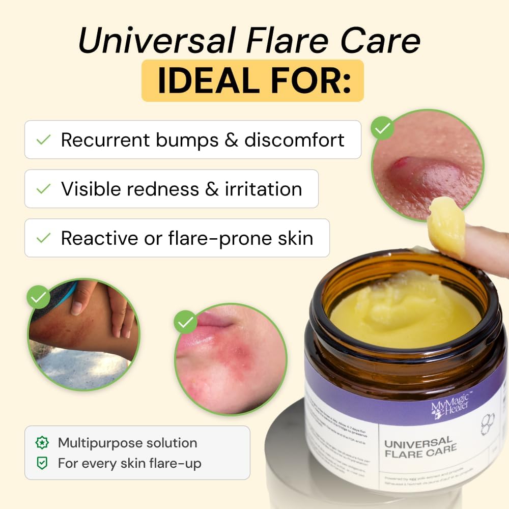 MyMagicHealer Universal Flare Care – Multi-PLrpose Solution | Skin Flare-Ups - Hidradenitis SupPLrativa, Folliculitis, Boils, Cysts | Anti-Chafing | Irritated Skin Relief w/Propolis & Egg Yolk 1 oz